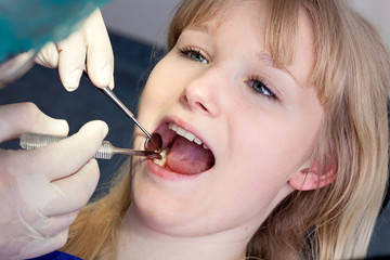 Woman having molars examined by a Dental-Surgeon.