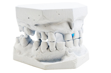 detailed macro of teeth molding