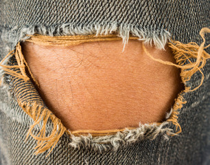 Torn jeans