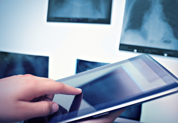 Working with digital tablet in radiology