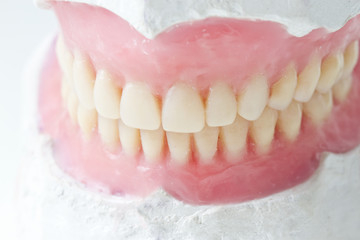 total dental prosthesis