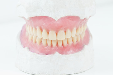 total dental prosthesis