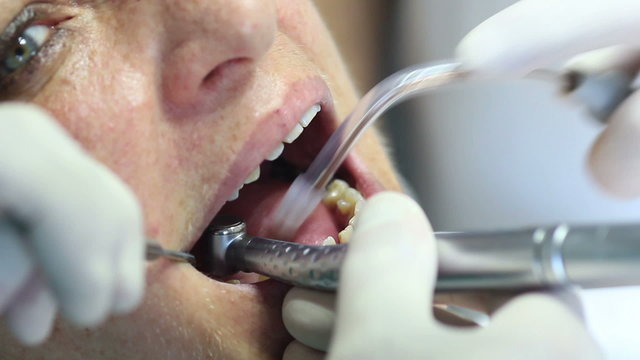 Dentist equipment - Female teeth being checked by doctor