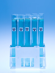 bio hazardous substance in laboratory test tubes