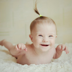 little girl with Down syndrome