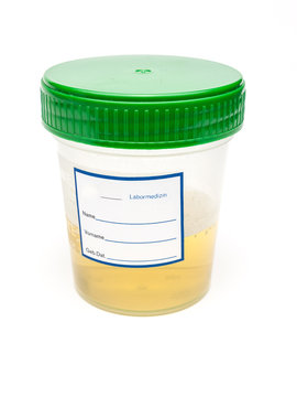 Urinprobe