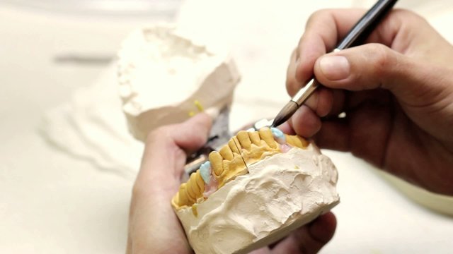 Dental implants laboratory. Dental implants (brushing)