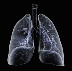X-Ray of human Lungs