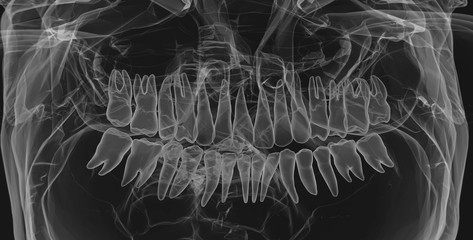 Human Teeth. X-Ray effect - 54039216