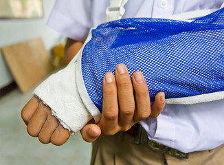 student's arm is broken