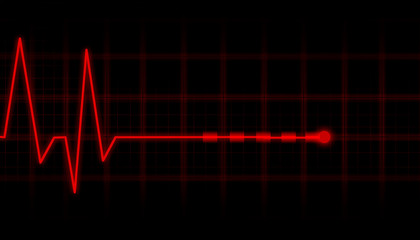 ECG Electrocardiogram.