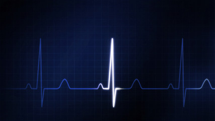 The blue graphic of EKG monitor