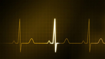 The gold graphic of EKG monitor