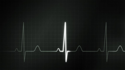black and white graphic of EKG monitor