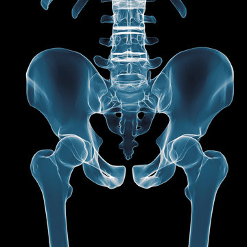 pelvis under the X-rays