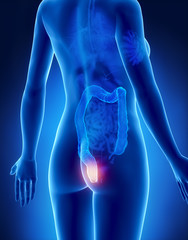 Female HEMORRHOIDS concept x-ray posterior view - obrazy, fototapety, plakaty