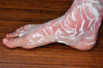 Treatment of sunburn
