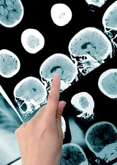 point to the imaging area. Doctor and CT-scan.