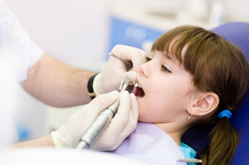 close-up medical dentist procedure of teeth polishing 