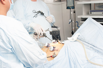 Gastric bypass surgery