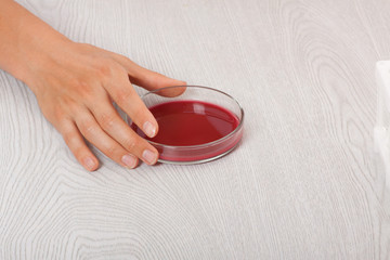 blood in petri dishes