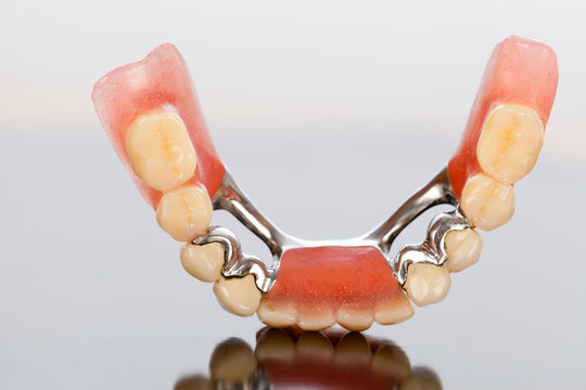 Ceracim crowns and dental prosthesis