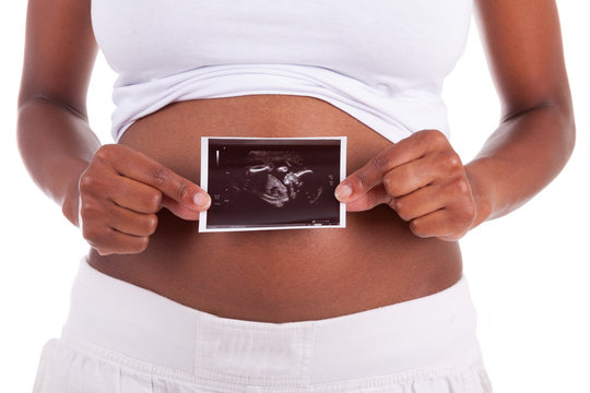 Young pregnant black woman holding an ultrasound picture in fron