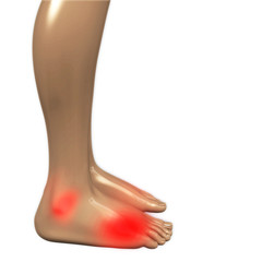 Fußgelenkschmerzen - 3D Render