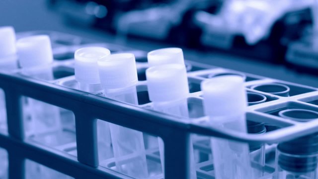 Medical Lab - test tubes - side track