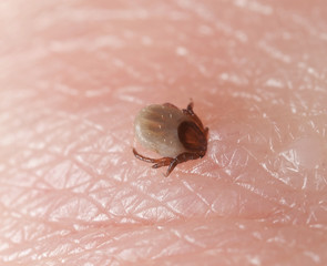 Tick, Ixodes ricinus biting human