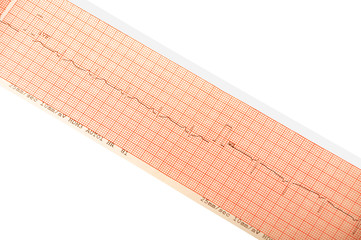 ECG print