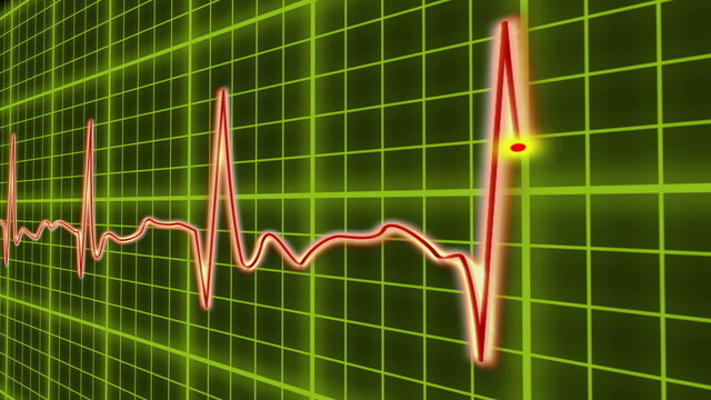 EKG cardio heart beat, normal and zero pulse with audio