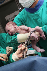 Bringing New Life into the World: Doctors Delivering a Newborn Baby Boy and Cutting the Umbilical Cord - obrazy, fototapety, plakaty