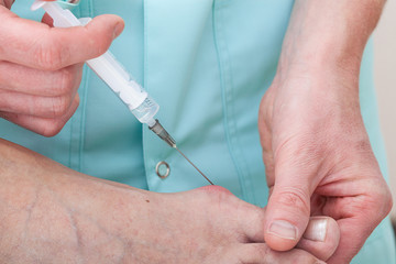 Painkiller injection