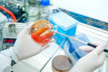 microbiology - bacteria culture