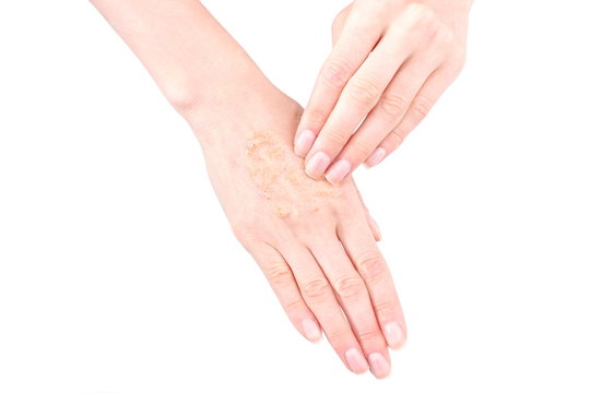 Hand of woman puts a cosmetic cream, peeling hand