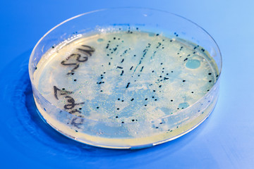 Petri dish