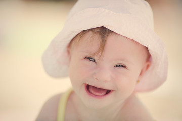 cheerful little baby girl with Downs Syndrome