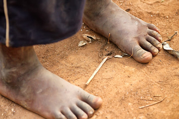 Feet