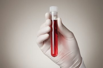 Doctor's hand with blood sample