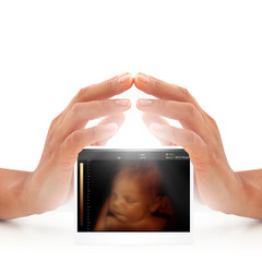 Woman hands over ultrasound of baby in mother's womb. Pregnancy