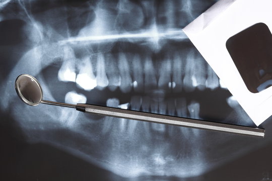X-ray scan of humans teeth