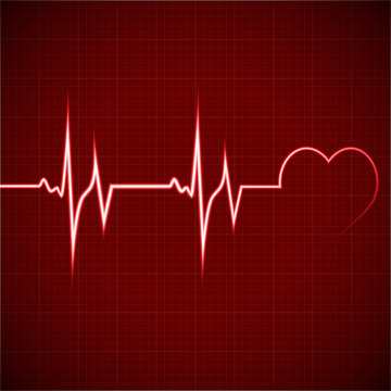 heart rhythm ekg