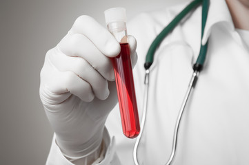 Doctor's hand with blood sample