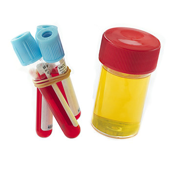 Analyse biologique - Sang & Urine