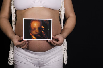 Futura Mamá