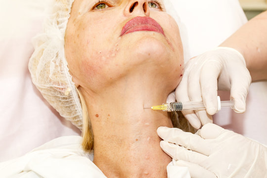 Cosmetic treatment with syringe injection in clinic