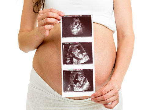 pregnant woman holding ultrasound scan on her tummy