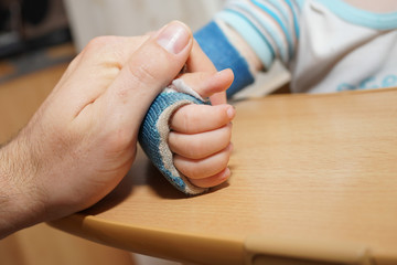Vater tröstet Kind mit Gips