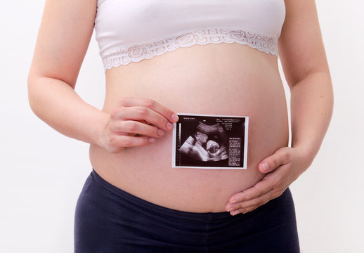 Pregnant woman with ultrasound photography
